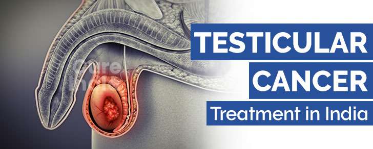 Testicular Cancer Treatment in India